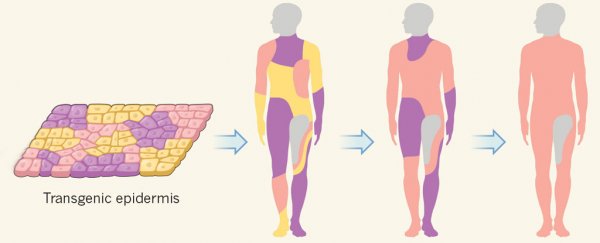 7-year-old boy with incurable condition has 80% of his skin genetically modified