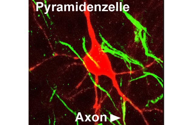 A New Type of Brain Cell Has Been Discovered : ScienceAlert
