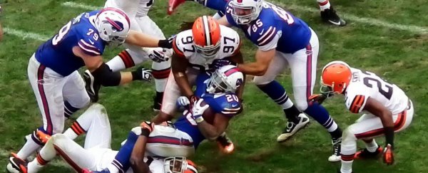 Brain trauma discovered in 99% of deceased NFL players in post-mortem study
