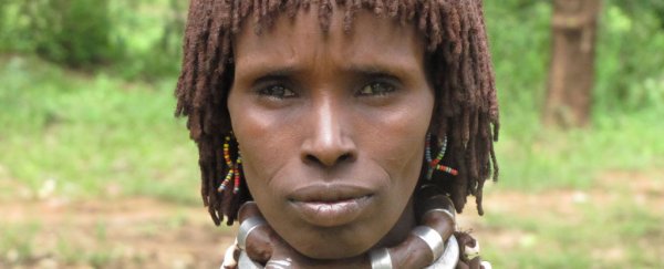 Gene variants that affect skin colour suggest the concept of race is deeply flawed