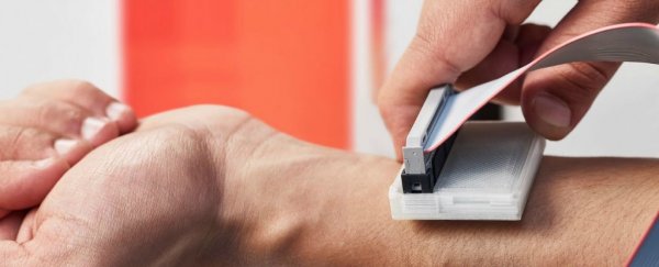 A team of students just won a prestigious award for this cheap skin cancer detector