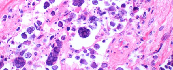 The latest FDA-approved treatment to fight cancer? Herpes