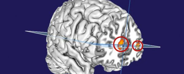 Scientists may have found the part of the brain that enables lucid dreaming