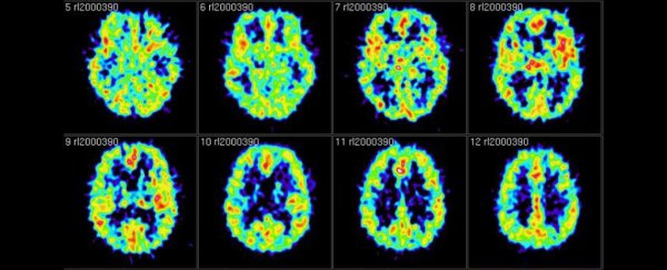 You can actively forget memories if you try, and scientists have the brain scans to prove it