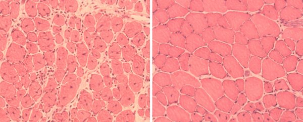 Cellular reprogramming has been used to reverse ageing in living animals for the first time