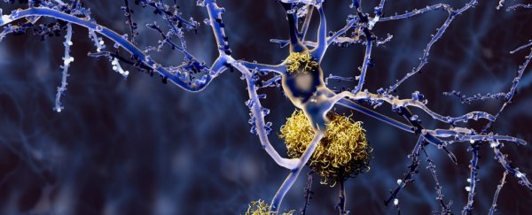 Researchers identify different 'types' of Alzheimer’s based on protein clumps in the brain