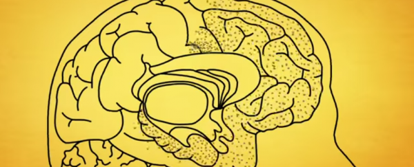 WATCH: This is exactly what Alzheimer’s does to the brain