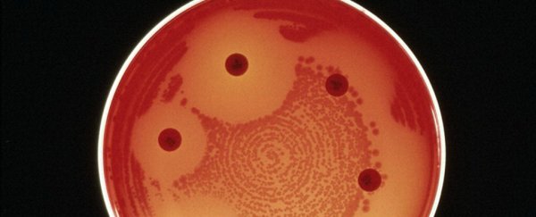 A superbug resistant to every available antibiotic has killed a woman in the US