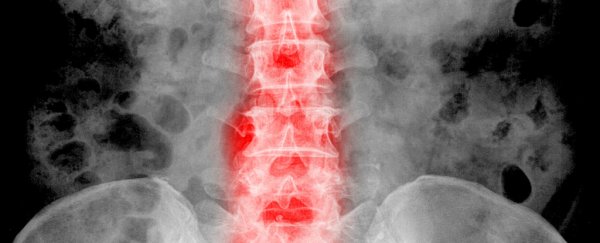 Research says back pain can be caused by depression