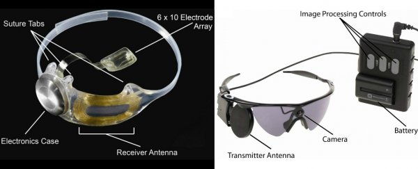 Results of 3-year clinical trial show the bionic eye safely restores vision