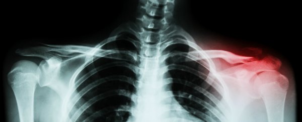 Your bones could soon heal a whole lot better thanks to polymer nanoshells