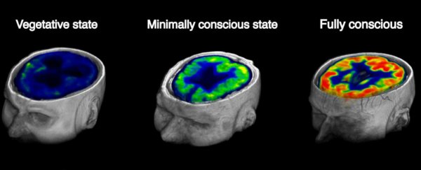 A simple test can predict whether coma patients will wake up within a year