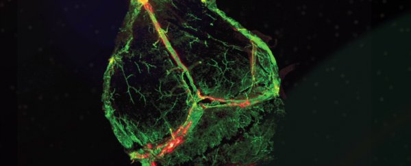 Scientists have discovered never-before-seen vessels in the brain