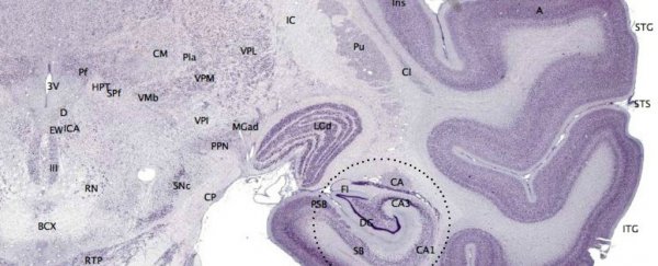 Brain structure might explain why boys are 5 times more likely to develop autism