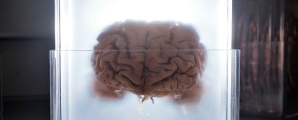 This could explain why large brains are more susceptible to mental illness