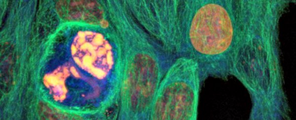 Depressing paper suggests cancer's an evolutionary mechanism to 'autocorrect' our gene pool