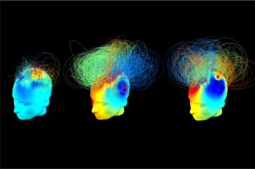 Scientists have found “hidden” brain activity that can indicate if a vegetative patient is aware