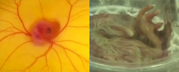 Watch a chick develop and hatch outside of the egg