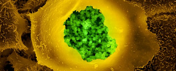 Scientists identify a virus and two bacteria that could be causing Alzheimer's