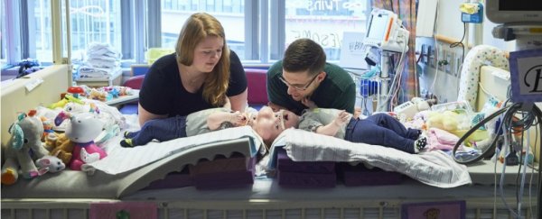 Doctors just separated twin girls joined at the head in one of the world's rarest surgeries