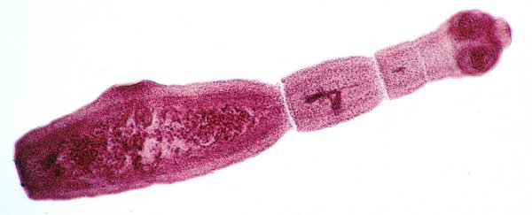 If your pet has this tapeworm, it could kill you
