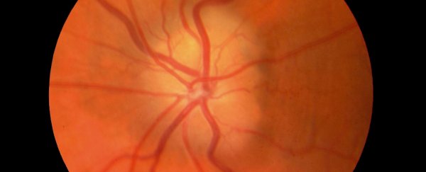 Parkinson's could be caught early by a simple eye test