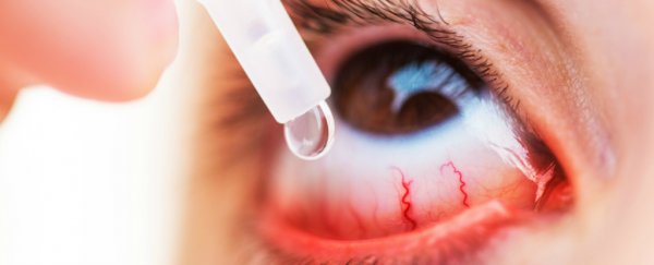 Doctors warn that people are mixing up superglue and eyedrops and oh god why