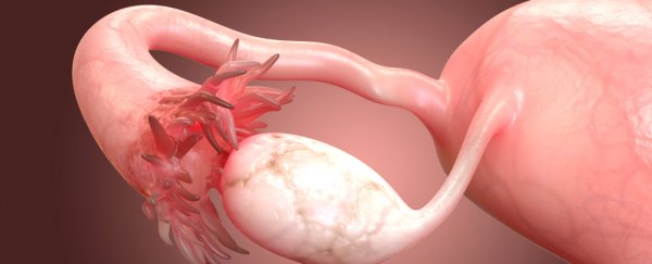 New Evidence Suggests Ovarian Cancer Might Not Start in The Ovaries