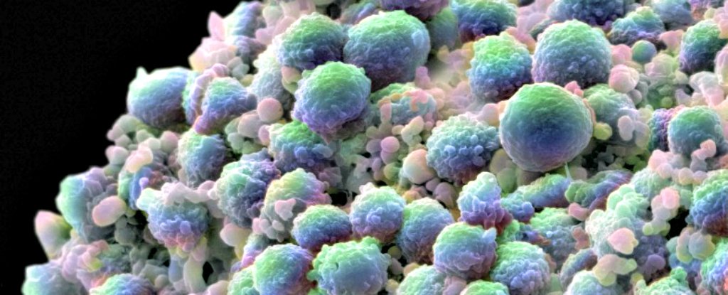 We Now Have More Evidence That Fat Fuels Cancer's Spread : ScienceAlert