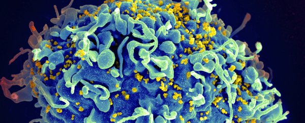 Scientists just set their sights on a new target for a HIV vaccine