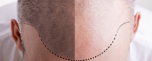 Scientists think they've finally found the mechanism behind grey hair and baldness