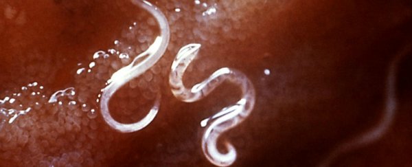 Scientists want to use parasitic worms to treat multiple sclerosis