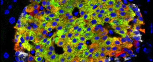 A brand new type of insulin-producing cell has been discovered hiding in the pancreas