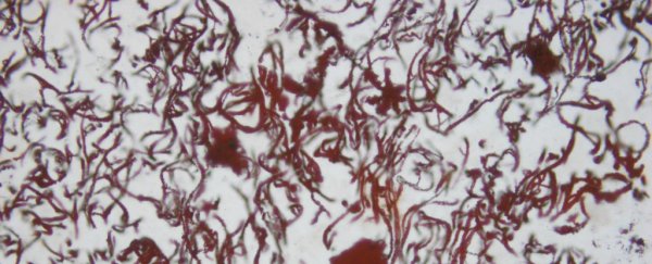 Scientists have unearthed remains of the world's oldest fossils