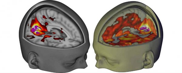 For the first time ever, scientists have imaged the brain on LSD