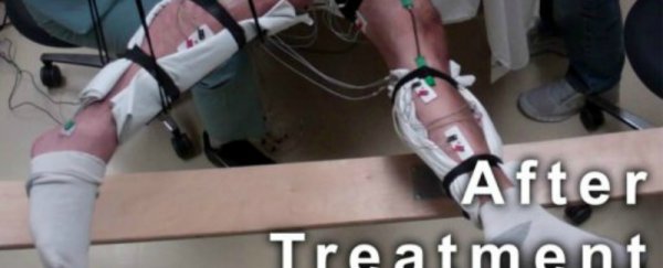 Paralysed patients take small steps thanks to a non-invasive new procedure