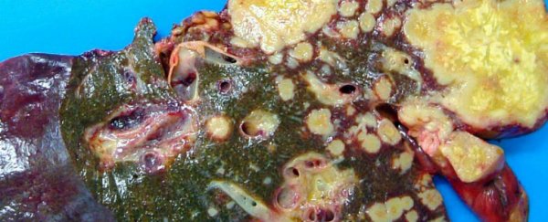 This cancer-causing parasite secretes a chemical that can heal wounds