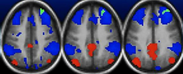 Brain scans reveal physical link between poverty and childhood depression