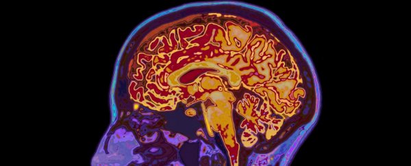 11 TED Talks that show how weird the human mind really is