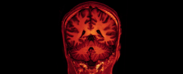Depression damages certain regions of the brain, study concludes