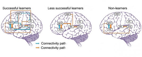 How learning a new language changes your brain - at any age