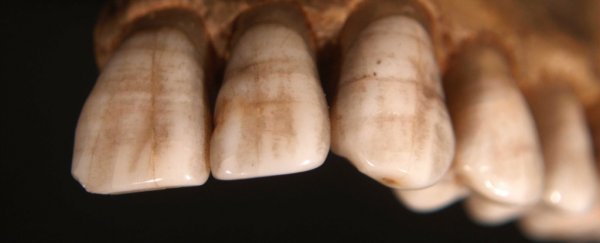 Prehistoric human teeth have revealed what the 'paleo diet' actually entailed