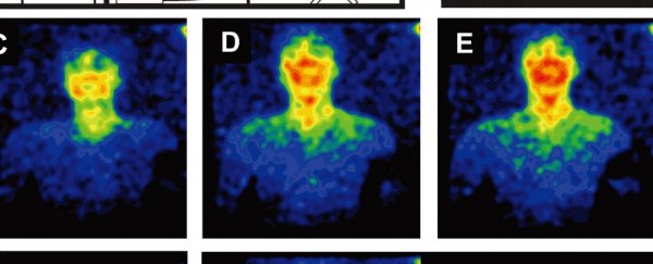 You can't see it, but humans actually glow with our own form of bioluminescence