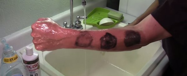 A retired scientist explains the trick to never getting a poison ivy rash again