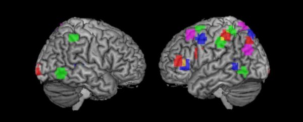 This is what your brain looks like on science