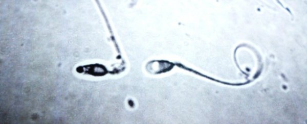 Sperm under a microscope