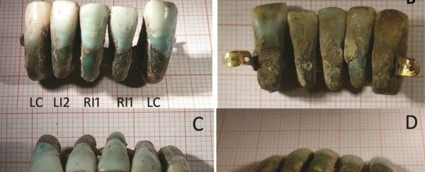 Researchers have found 400-year-old false teeth, and they're incredibly creepy