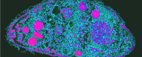 Here's how parasites could be influencing the way you think