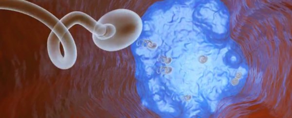 This new type of male contraceptive not only prevents babies; it's completely reversible