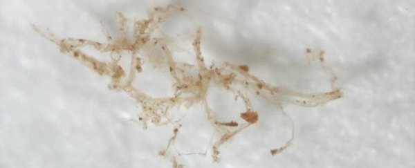 Scientists confirm they've found 80-million-year-old dinosaur blood vessels